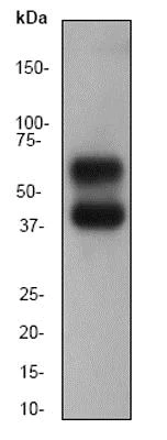 Western blot - Anti-CaMKII antibody [EP1829Y] (AB52476)