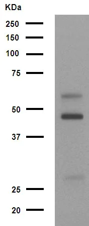 Western blot - Anti-CaMKII antibody [EP1829Y] (AB52476)
