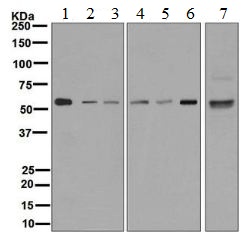 Western blot - Anti-CaMKII antibody [EPR6685(B)] - BSA and Azide free (AB248185), expandable thumbnail