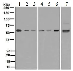 Western blot - Anti-CaMKII antibody [EPR6685(B)] - BSA and Azide free (AB248185)