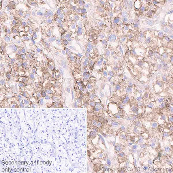 Immunohistochemistry (Formalin/PFA-fixed paraffin-embedded sections) - Anti-CaMKII antibody [EPR6686(2)] (AB134041)