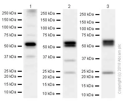 Western blot - Anti-CaMKII antibody [EPR6686(2)] (AB134041)