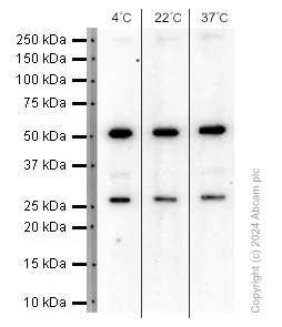 Western blot - Anti-CaMKII antibody [EPR6686(2)] (AB134041)