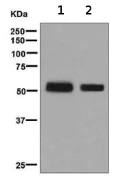 Western blot - Anti-CaMKII antibody [EPR6686(2)] (AB134041)