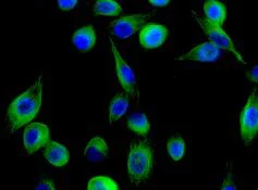 Immunocytochemistry/ Immunofluorescence - Anti-CaMKII antibody [EPR6686(2)] - BSA and Azide free (AB227108)