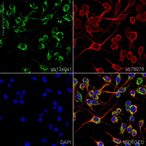 Immunocytochemistry/ Immunofluorescence - Anti-CaMKII antibody [EPR6686(2)] - BSA and Azide free (AB227108)