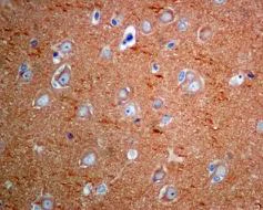 Immunohistochemistry (Formalin/PFA-fixed paraffin-embedded sections) - Anti-CaMKII antibody [EPR6686(2)] - BSA and Azide free (AB227108)