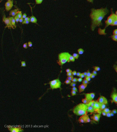 Immunocytochemistry/ Immunofluorescence - Anti-CaMKII beta antibody (AB34703)