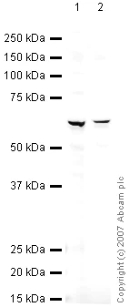 Western blot - Anti-CaMKII beta antibody (AB34703)