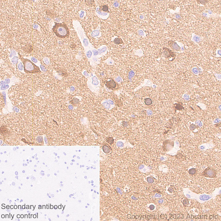 Immunohistochemistry (Formalin/PFA-fixed paraffin-embedded sections) - Anti-CaMKII beta antibody [EPR28076-54] (AB314897)