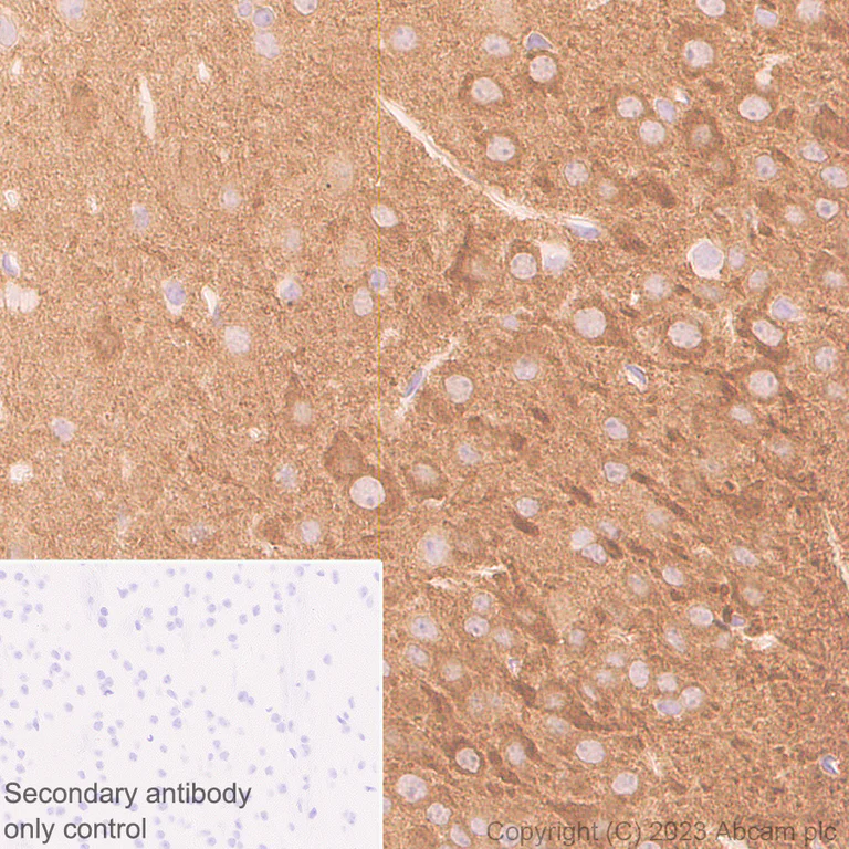Immunohistochemistry (Formalin/PFA-fixed paraffin-embedded sections) - Anti-CaMKII beta antibody [EPR28076-54] (AB314897)