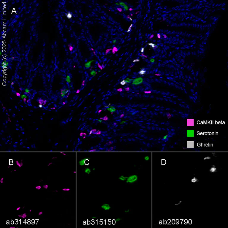 Multiplex immunohistochemistry - Anti-CaMKII beta antibody [EPR28076-54] (AB314897)