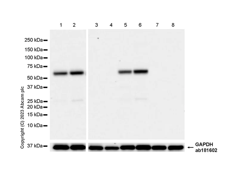 Western blot - Anti-CaMKII beta antibody [EPR28076-54] (AB314897)