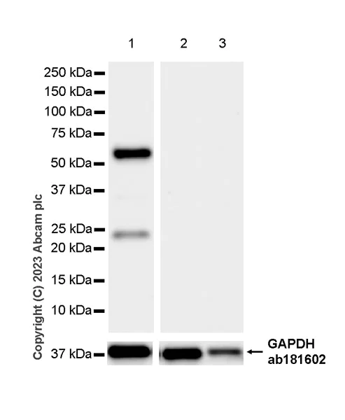Western blot - Anti-CaMKII beta antibody [EPR28076-54] (AB314897)