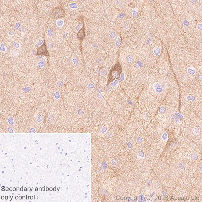 Immunohistochemistry (Formalin/PFA-fixed paraffin-embedded sections) - Anti-CaMKII beta antibody [EPR28076-54] - BSA and Azide free (AB314898)