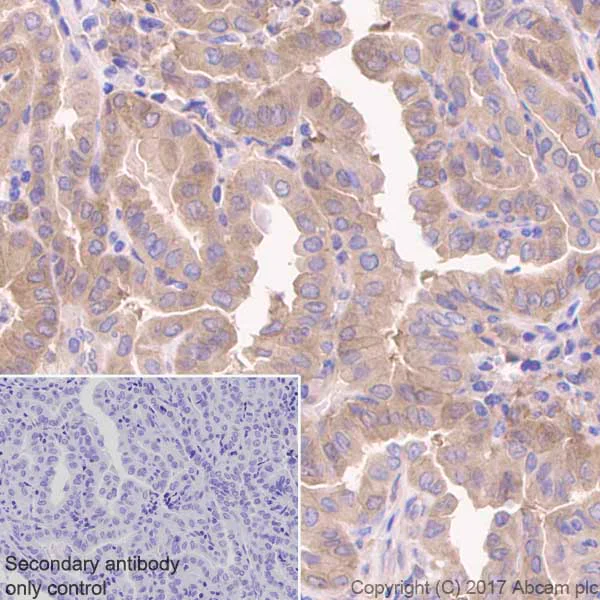 Immunohistochemistry (Formalin/PFA-fixed paraffin-embedded sections) - Anti-CaMKII delta antibody [EPR13095] (AB181052)