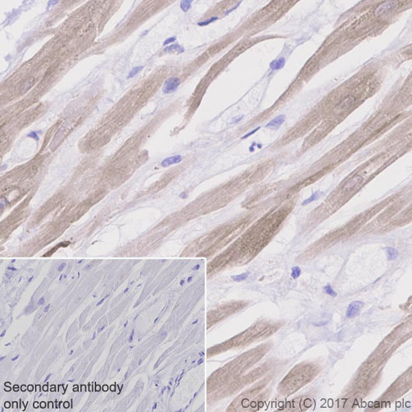 Immunohistochemistry (Formalin/PFA-fixed paraffin-embedded sections) - Anti-CaMKII delta antibody [EPR13095] (AB181052)