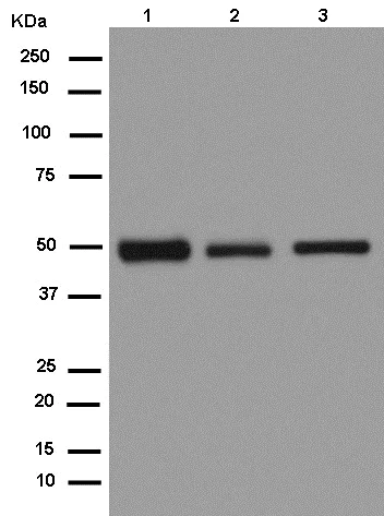 Western blot - Anti-CaMKII delta antibody [EPR13095] (AB181052)