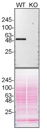 Western blot - Anti-CaMKII delta antibody [EPR13095] (AB181052)