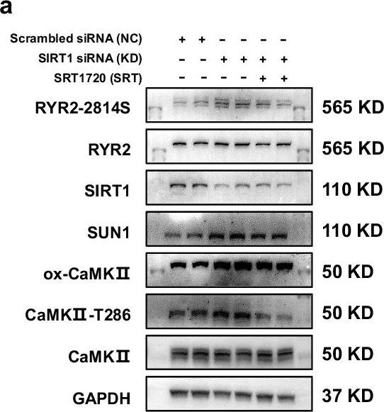 Western blot - Anti-CaMKII delta antibody [EPR13095] (AB181052)