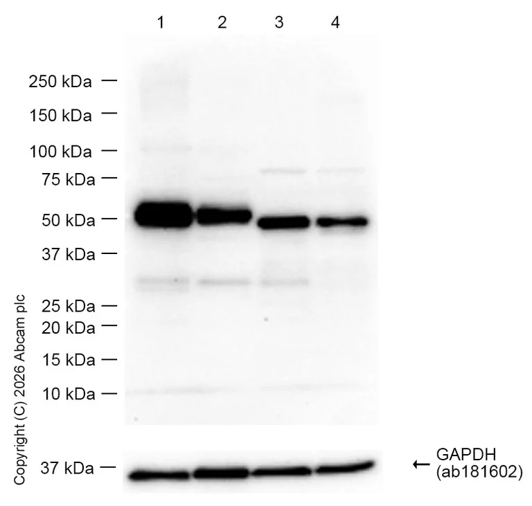 Western blot - Anti-CaMKII delta antibody [EPR13095] (AB181052)