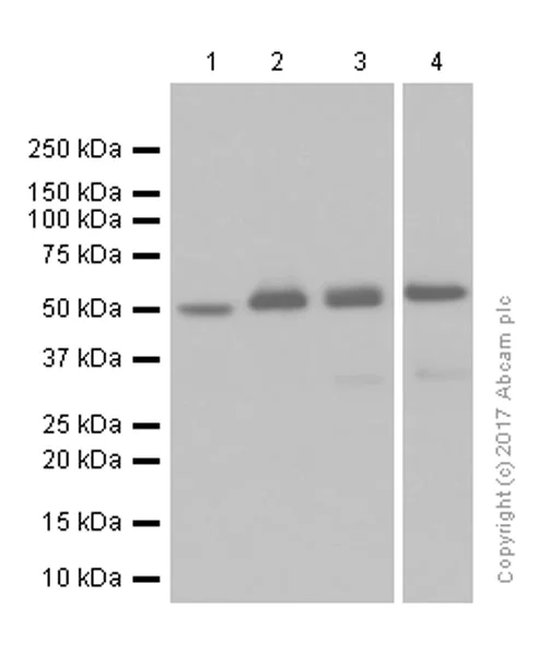 Western blot - Anti-CaMKII delta antibody [EPR13095] (AB181052)