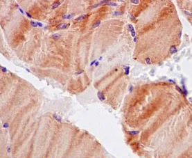 Immunohistochemistry (Formalin/PFA-fixed paraffin-embedded sections) - Anti-CaMKII delta antibody [EPR13095] - BSA and Azide free (AB191588)