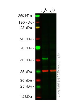 Western blot - Anti-CaMKII delta antibody [EPR13095] - BSA and Azide free (AB191588)