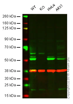 Western blot - Anti-CaMKII delta antibody [EPR13095] - BSA and Azide free (AB191588)