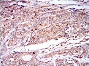 Immunohistochemistry (Formalin/PFA-fixed paraffin-embedded sections) - Anti-CamKII gamma antibody [8G10C1] (AB201966)