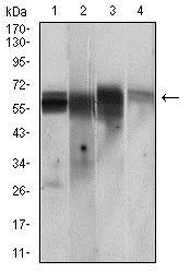 Western blot - Anti-CamKII gamma antibody [8G10C1] (AB201966)