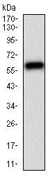 Western blot - Anti-CamKII gamma antibody [8G10C1] (AB201966)