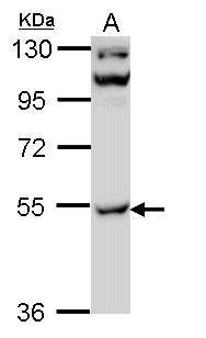 Western blot - Anti-CamKII gamma antibody (AB262701), expandable thumbnail