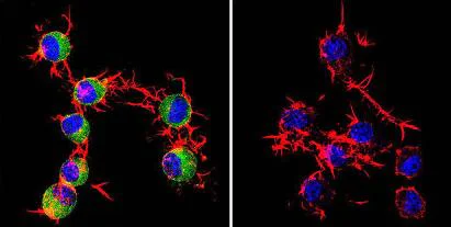 Immunocytochemistry/ Immunofluorescence - Anti-CaMKII (phospho T286) antibody [22B1] (AB171095)