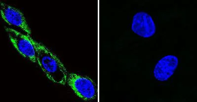 Immunocytochemistry/ Immunofluorescence - Anti-CaMKII (phospho T286) antibody [22B1] (AB171095)