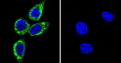 Immunocytochemistry/ Immunofluorescence - Anti-CaMKII (phospho T286) antibody [22B1] (AB171095)