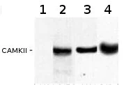 Western blot - Anti-CaMKII (phospho T286) antibody [22B1] (AB171095)