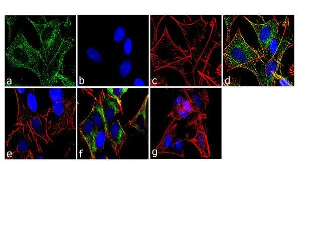 Immunocytochemistry/ Immunofluorescence - Anti-CaMKII (phospho T305 + T306) antibody [2HCLC] (AB277784)