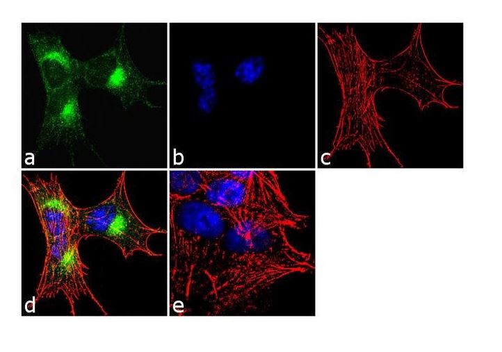 Immunocytochemistry/ Immunofluorescence - Anti-CAMKIV antibody (AB3557)