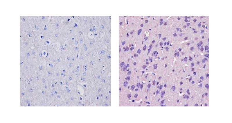 Immunohistochemistry (Formalin/PFA-fixed paraffin-embedded sections) - Anti-CAMKIV antibody (AB3557)