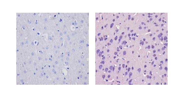 Immunohistochemistry (Formalin/PFA-fixed paraffin-embedded sections) - Anti-CAMKIV antibody (AB3557)