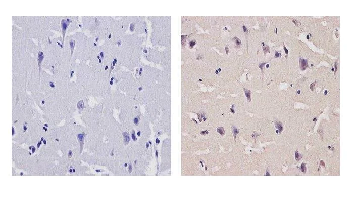 Immunohistochemistry (Formalin/PFA-fixed paraffin-embedded sections) - Anti-CAMKIV antibody (AB3557)