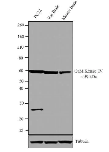 Western blot - Anti-CAMKIV antibody (AB3557)