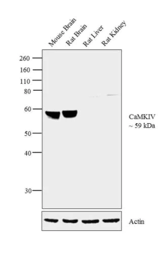 Western blot - Anti-CAMKIV antibody (AB3557)