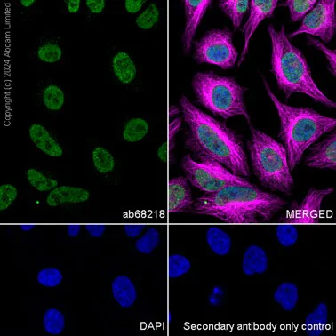 Immunocytochemistry/ Immunofluorescence - Anti-CAMKIV antibody [EP2565AY] - BSA and Azide free (AB247379)