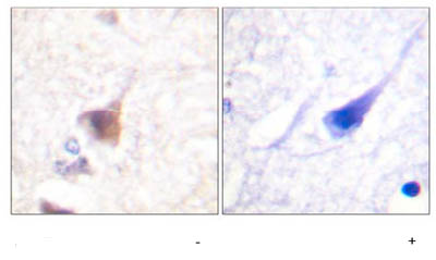 Immunohistochemistry (Formalin/PFA-fixed paraffin-embedded sections) - Anti-CAMKIV (phospho T196 + T200) antibody (AB59424)