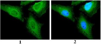 Immunocytochemistry/ Immunofluorescence - Anti-CAMKK2 antibody (AB96531), expandable thumbnail