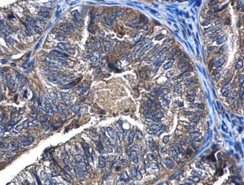 Immunohistochemistry (Formalin/PFA-fixed paraffin-embedded sections) - Anti-CAMKK2 antibody (AB96531)