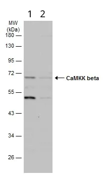 Western blot - Anti-CAMKK2 antibody (AB96531)