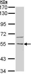 Western blot - Anti-CAMKK2 antibody (AB96531), expandable thumbnail